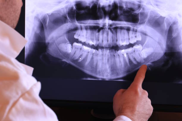 Best Emergency Dental Care for Abscessed Tooth in Marysville, OH