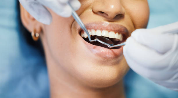 Best Orthodontic Emergency Dentist in Marysville, OH